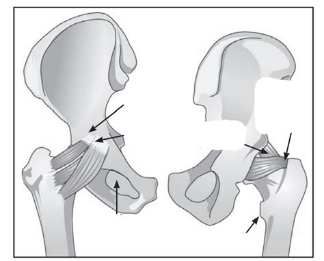 ligaments of the hip Diagram | Quizlet