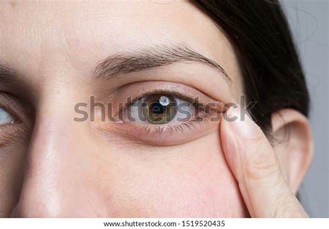 15743 Pulling Eye Images Stock Photos And Vectors Shutterstock
