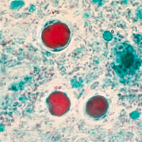 Blastocystis Species - Clinical Tree