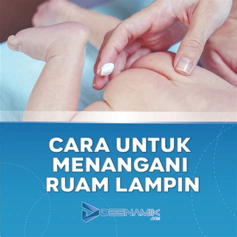 Cara Untuk Menangani Masalah Ruam Lampin Pada Bayi Anda