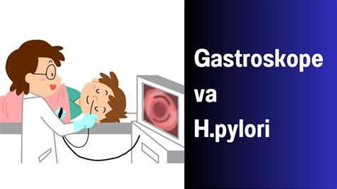 Gastroskope Va Oshqozon Kasalligi Video Youtube