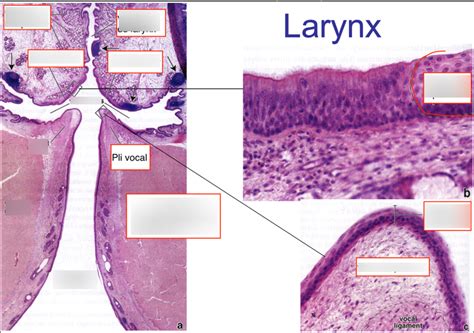 Diagramme De Coupe Larynx Quizlet