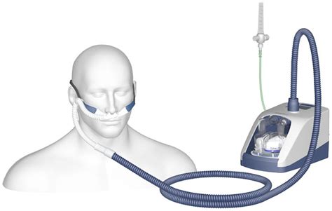 High Flow Nasal Cannula