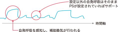 人工呼吸器の換気モードとは？ 看護roo [カンゴルー]