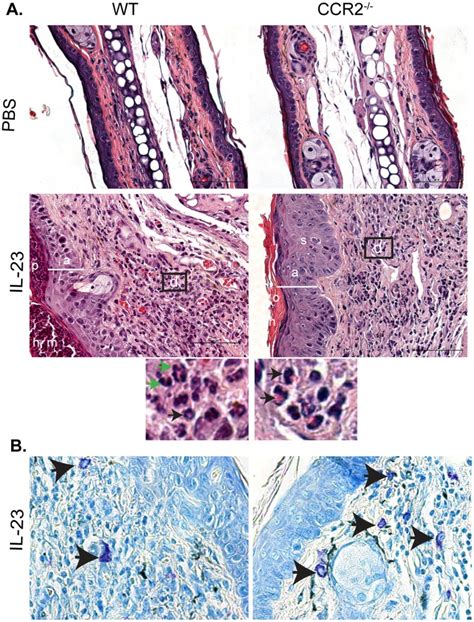 A Hande Stained Sections Of Ears From Il 23 Injected Wt And Ccr2− −