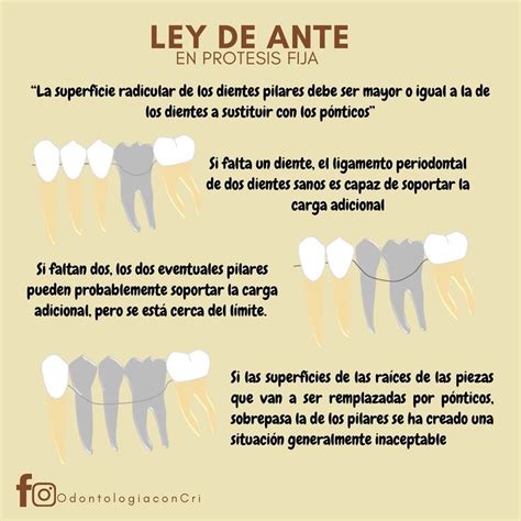 Ley de ante odontología con Cri Odontología Higienista dental