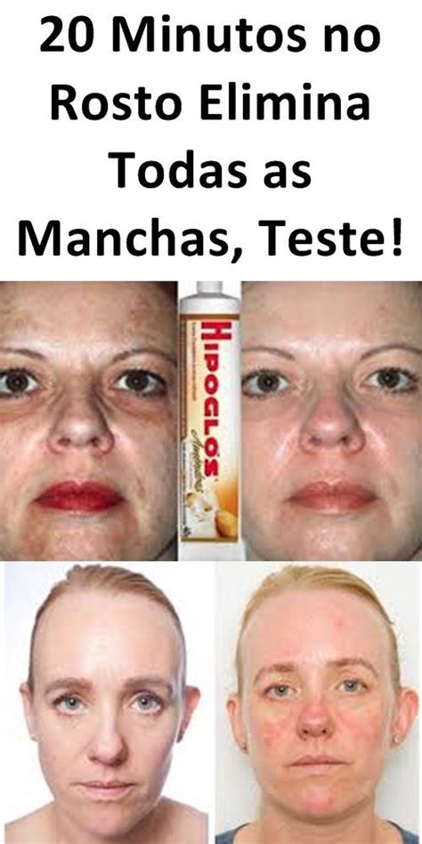 Minutos No Rosto Para Tirar Manchas Rugas E Flacidez Na Pele Use E