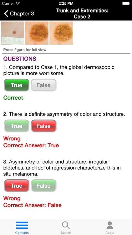 Dermoscopy Self Assessment By Usatine And Erickson Media Llc