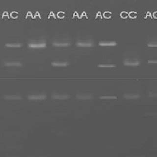 RFLP Analysis Of XPD Lys751Gln Rs13181 Lane M 50 Bp DNA Ladder AA