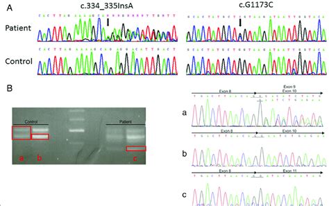 Sanger Sequencing And Cdna Analysis A Sanger Sequencing Of The Pgap