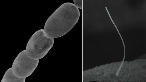 World S Largest Bacterium Discovered First To Be Visible With Naked Eye