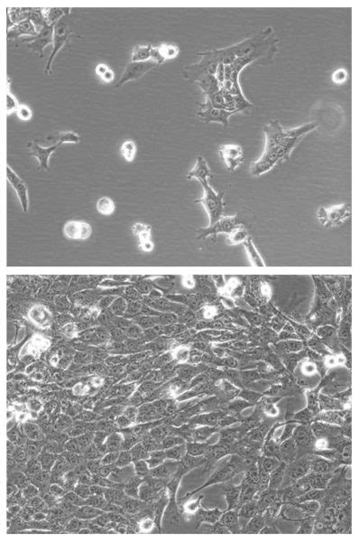 4T1 IRFP Puro Mammary Carcinoma Cell Line Imanis Life Sciences