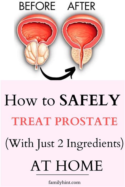 Prostate Health Simple Tricks To Prostate Help