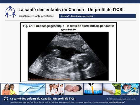 Le Test De Clart Nucale Fait Appel Des Ultrasons Pour D Pister Le