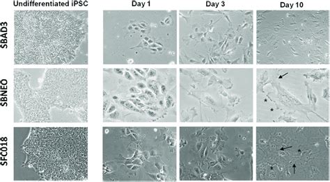 Morphological Changes Of Cells During Differentiation Of Human Ipsc