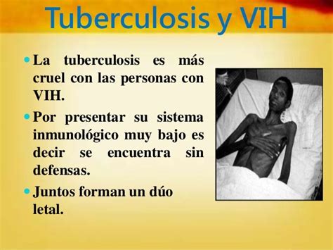 SÍntomas De La Tuberculosis