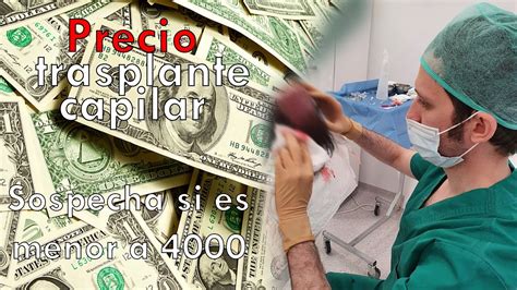 Injerto Capilar En Mujeres Todo Lo Que Necesitas Saber Sobre El Precio