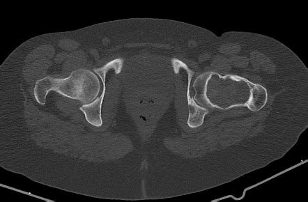 Image Radiopaedia Org