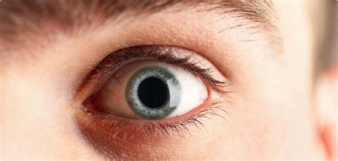 Quando A Pupila Dilata - Pupila Dilatada: Quando é Normal ou um Sinal de Alerta
