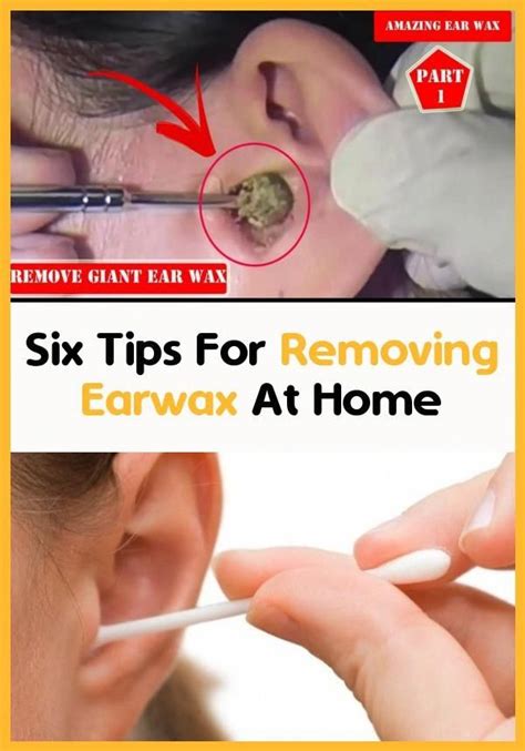 Six Tips To Home Remove Earwax Ear Wax Natural Lubricant How To Remove