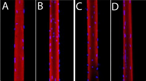 Confocal Microscopy Images Of Single Muscle Fibers From Mouse EDL A