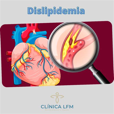 O que é dislipidemia Clinica LFM