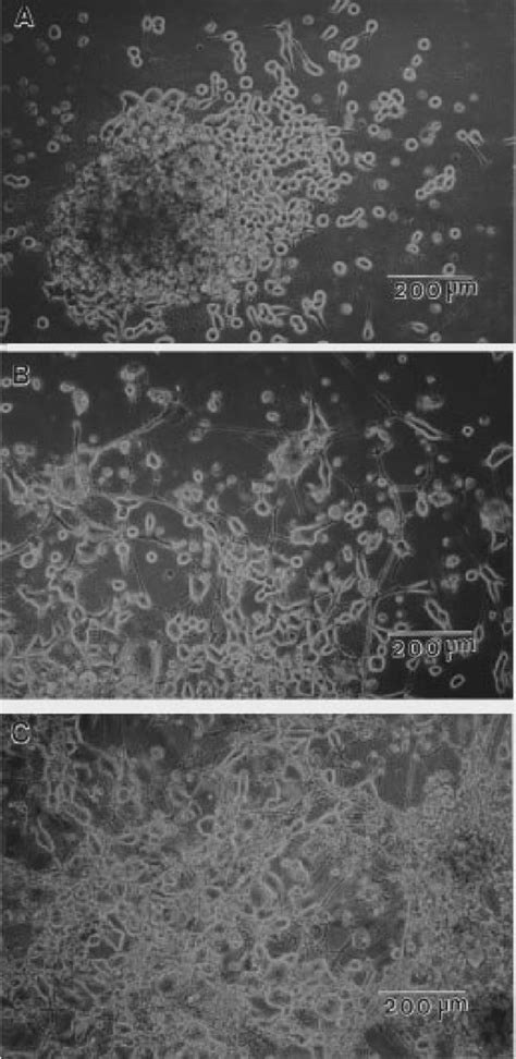 Representative N E Phase Contrast Micrographs After Days Of