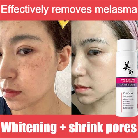 3 Days EffectiveEffective Whitening Freckle Cream Original