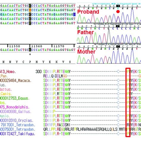 Pdf Trio Based Whole Exome Sequencing Identifies A De Novo Efnb