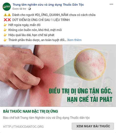 Hướng Dẫn Cách Xử Lý Khi Bị Dị Ứng Thuốc Tại Nhà Đúng Cách Nhất