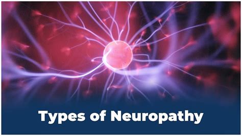 Different Types Of Neuropathy Youtube