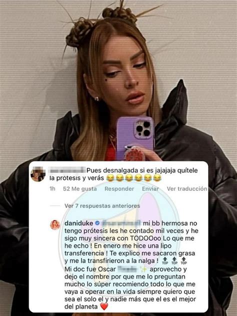 Dani Duke Explicó Cuál Fue La Intervención Que Se Hizo En La Cola Infobae