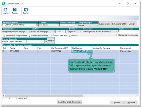 Cómo contabilizar un REP