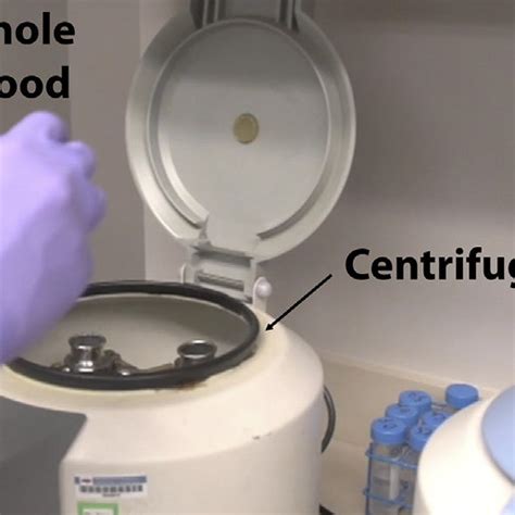 Centrifugation tube and contents after first centrifugation. After the ...