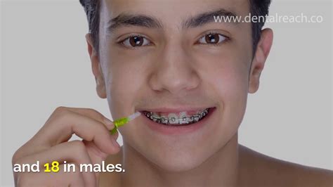 Magic Of Orthodontics Dentalreach Youtube