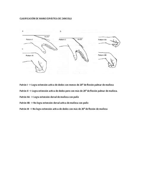 Clasificación De Mano Espástica De Zancolli Pdf