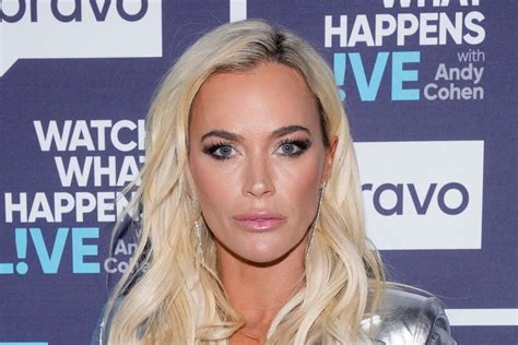 Teddi Mellencamp Admits to Mistakes in Update Amid Split | The Daily Dish