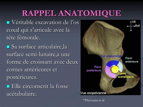 Ppt Les Fractures Du Cotyle Ce Quattend Le Chirurgien Du Radiologue