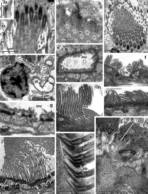 Ultrastructure of the protonephridial complex and excretory ducts of ...