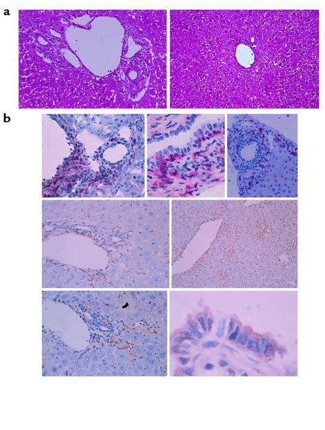 Jci Active Participation Of Ccr5cd8 T Lymphocytes In The