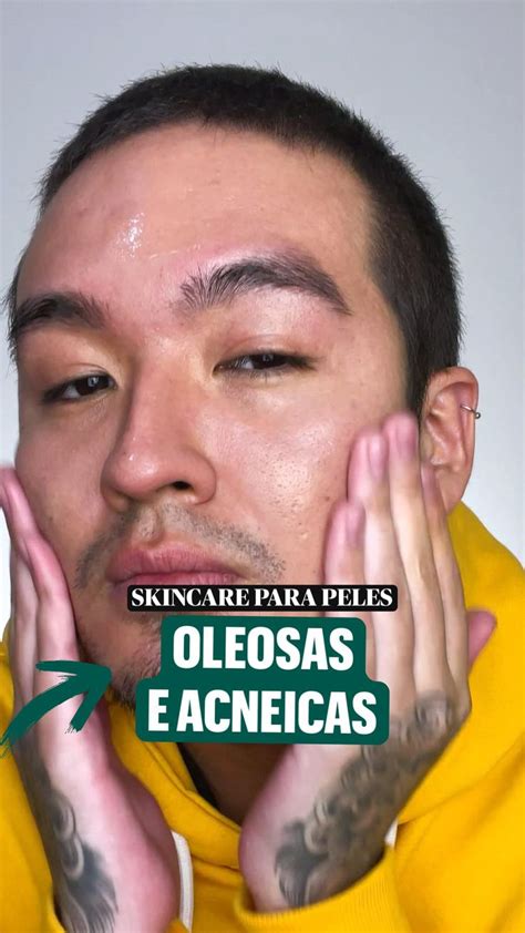 Rotina De Skincare Para Peles Oleosas E Acneicas Leo De Melaleuca