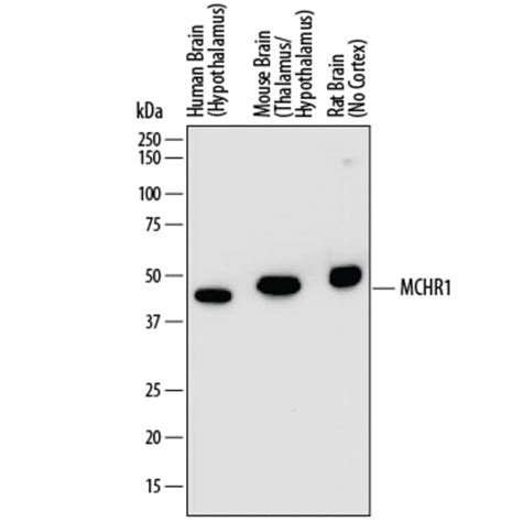 Mchr1 Mouse Anti Human Mouse Rat Clone 851047 R D Systems 100ug