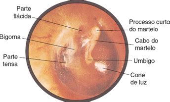 Otoscopia Aspectos Fundamentais Colunistas Sanarmed