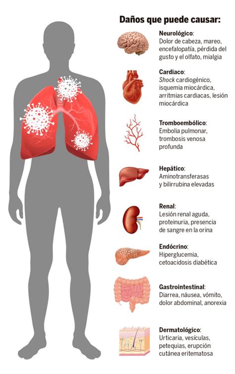La Enfermedad Covid Afecta Sist Micamente Al Organismo Gaceta Unam