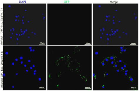 Shnotch Gsc Exo Internalization In Gscs Gscs Were Incubated With