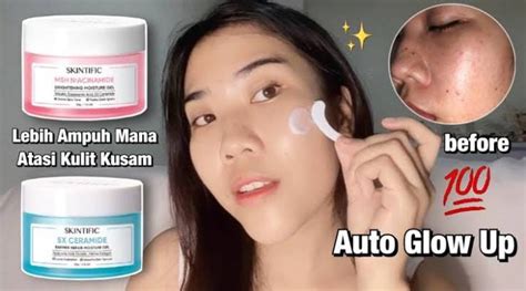 5 Moisturizer Terbaik Untuk Kulit Kering Dan Kusam Bikin Lembap