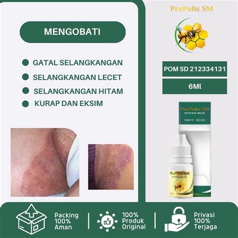 Jual Mafaza Herbs Obat Gatal Selangkangan Tinea Cruris Infeksi