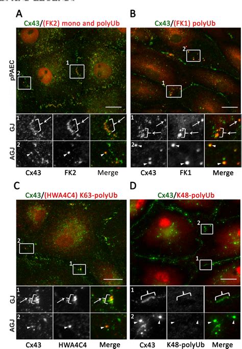 Phosphorylation Induced K63 Polyubiquitination Of Connexin 43 Regulates