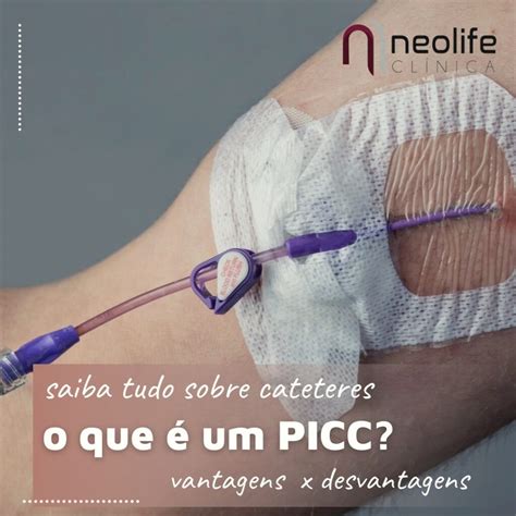 O Que O Cateter Picc Neolife Cl Nica