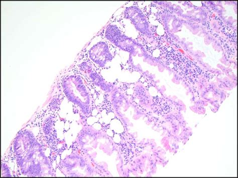 Colonic Specimen 43 Magnification Hematoxylin And Eosin Stain Download Scientific Diagram